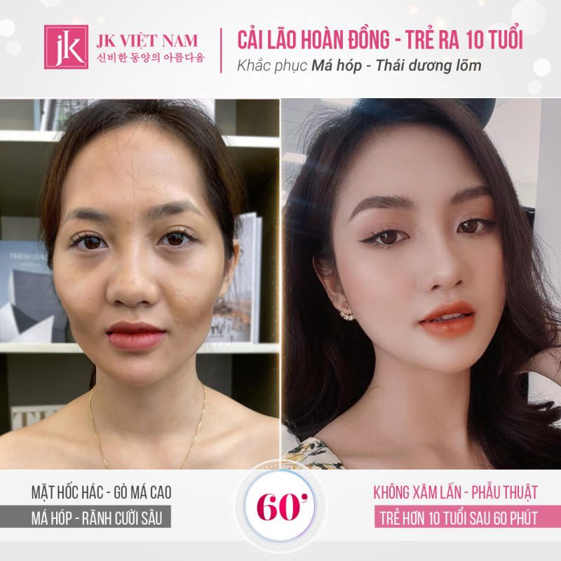 Bài PR dạng So sánh (before/after)